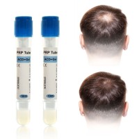 skin rejuvenation hair loss treatment prp blood collection tubes