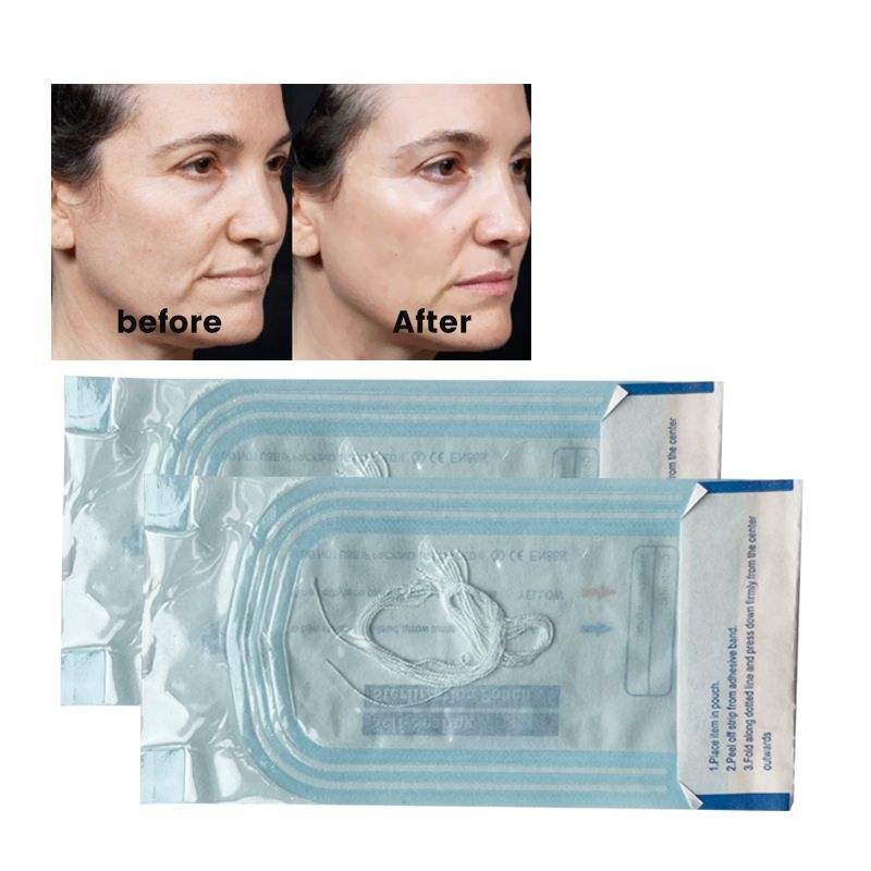 no needle dissolvable face lifting silk protein collagen threads