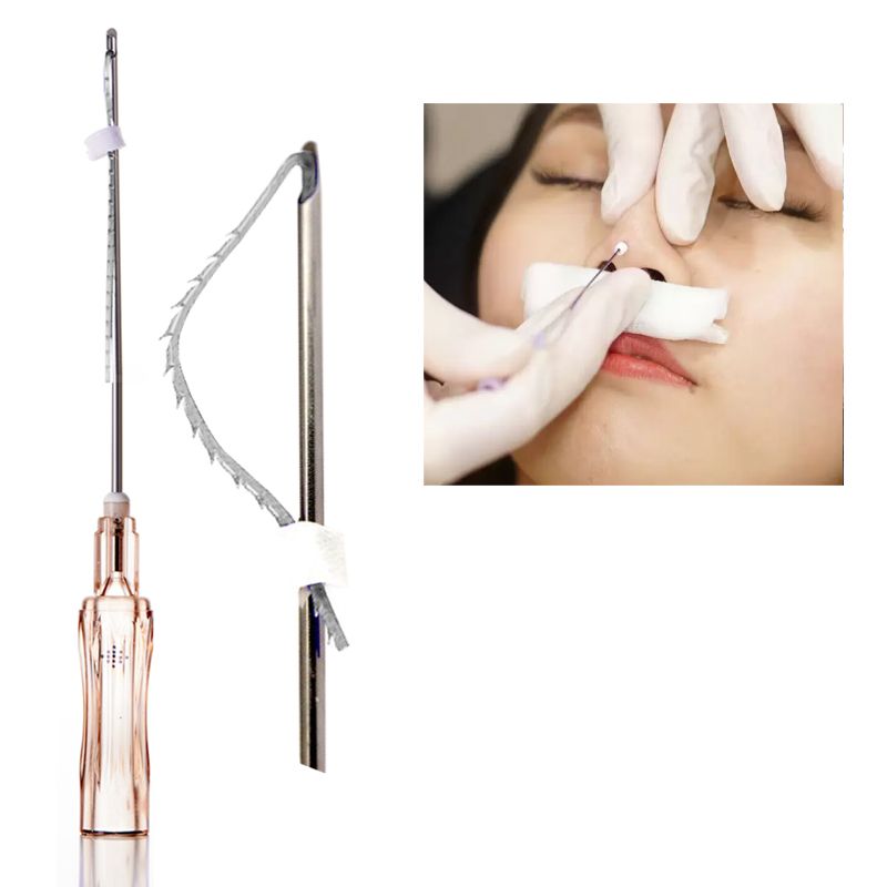 Nasal ridge lift tip treatment L 19g pcl nose thread