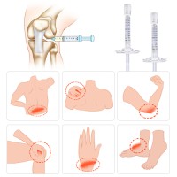 non cross-linked injection dermal filler hyaluronic acid for knee osteoarthritis