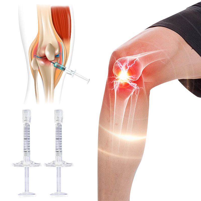 non cross-linked injection dermal filler hyaluronic acid for knee osteoarthritis