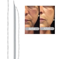 Face wrinkle removal sharp needle 26g 27g pcl tornado thread